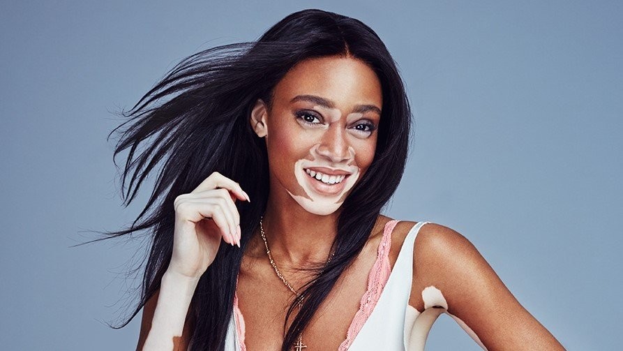 winnie-harlow.jpg