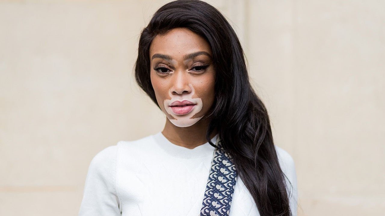winnie-harlow.jpg